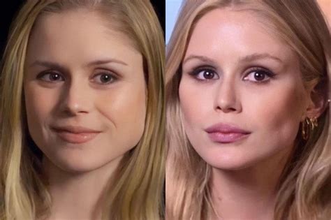 erin moriarty before surgery|Erin Moriarty Before and After Plastic Surgery Journey。